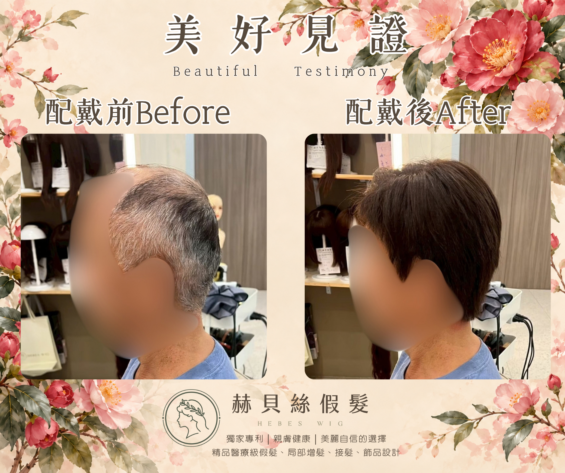 高先生的美好見證:用過,更懂得比較——赫貝絲男性假髮,找回年輕二十歲的帥氣英姿|配戴前後對比照