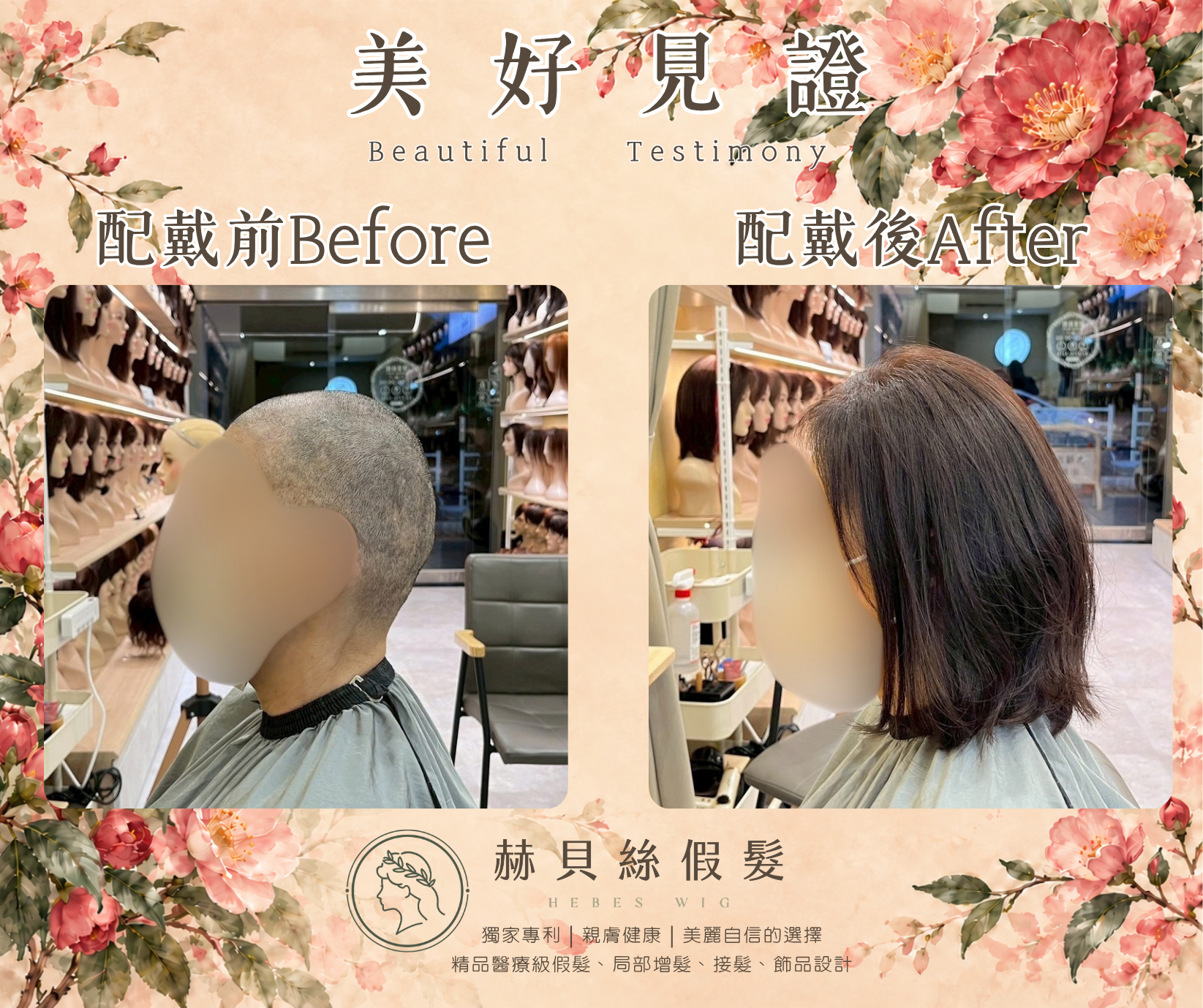 孫女士的美好見證:癌友互助社群的一份推薦,共同的自信與喜悅|配戴前後對比照