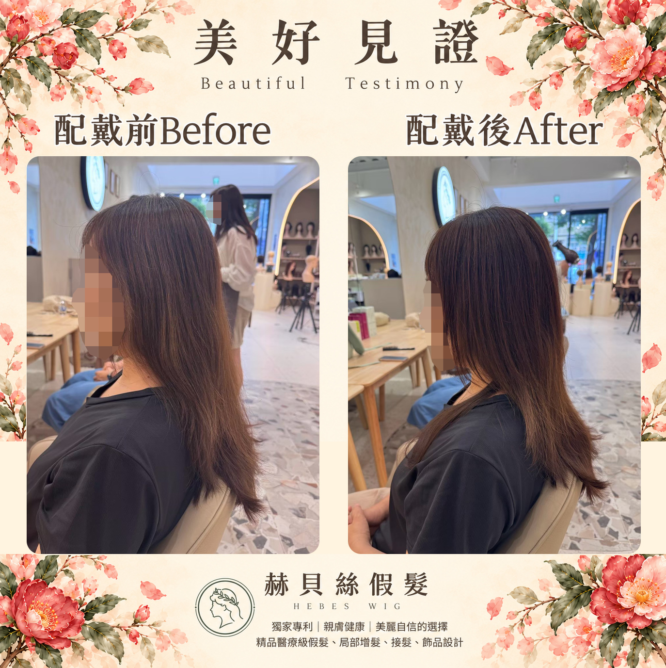 文小姐的美好見證:把心力留給生活,把美麗與自信還給自己|配戴前後對比照