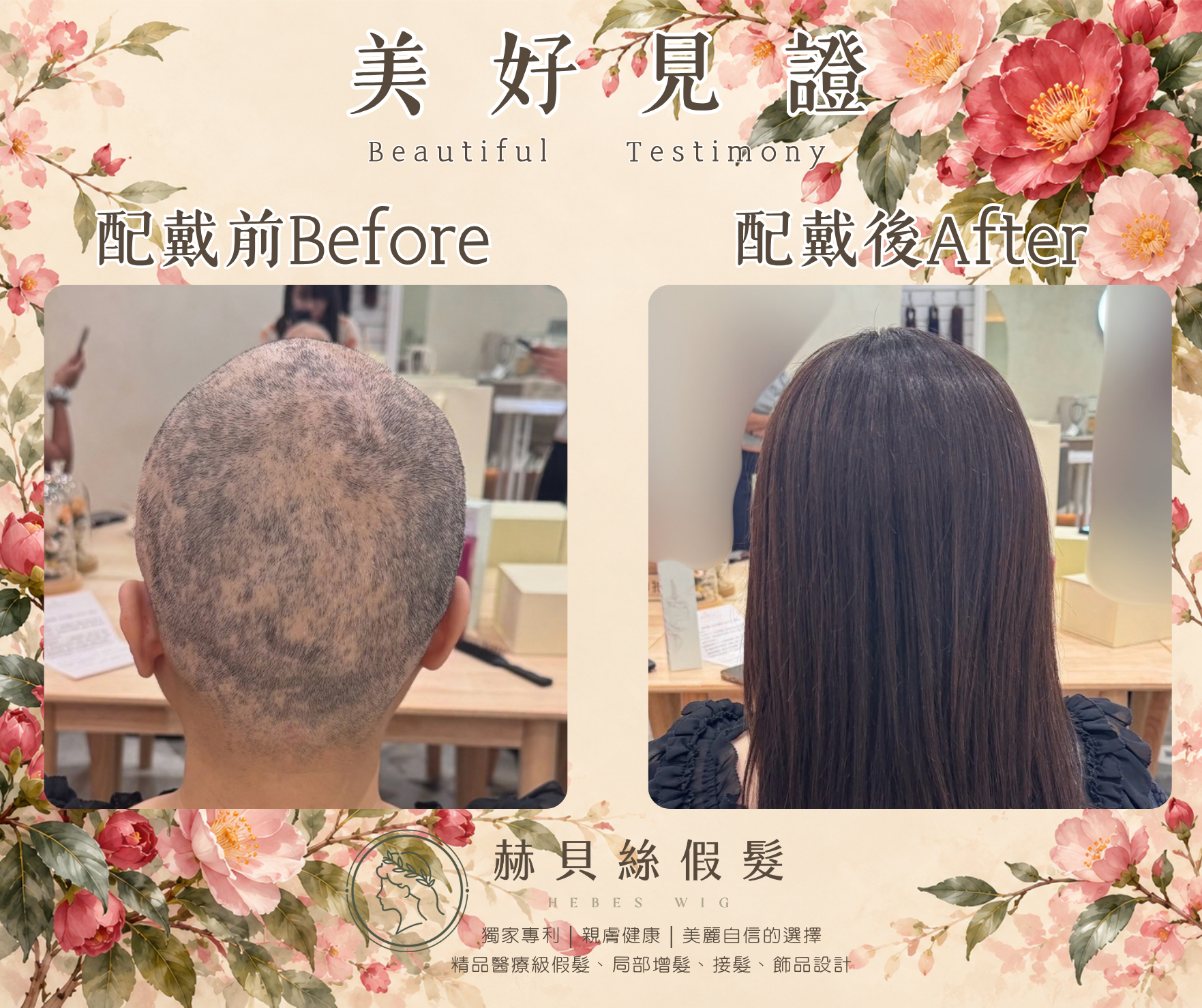 姚女士的美好見證:一份癌友間的推薦,一家人共同的喜悅。醫療假髮,溫柔陪伴自信回來|配戴前後對比照