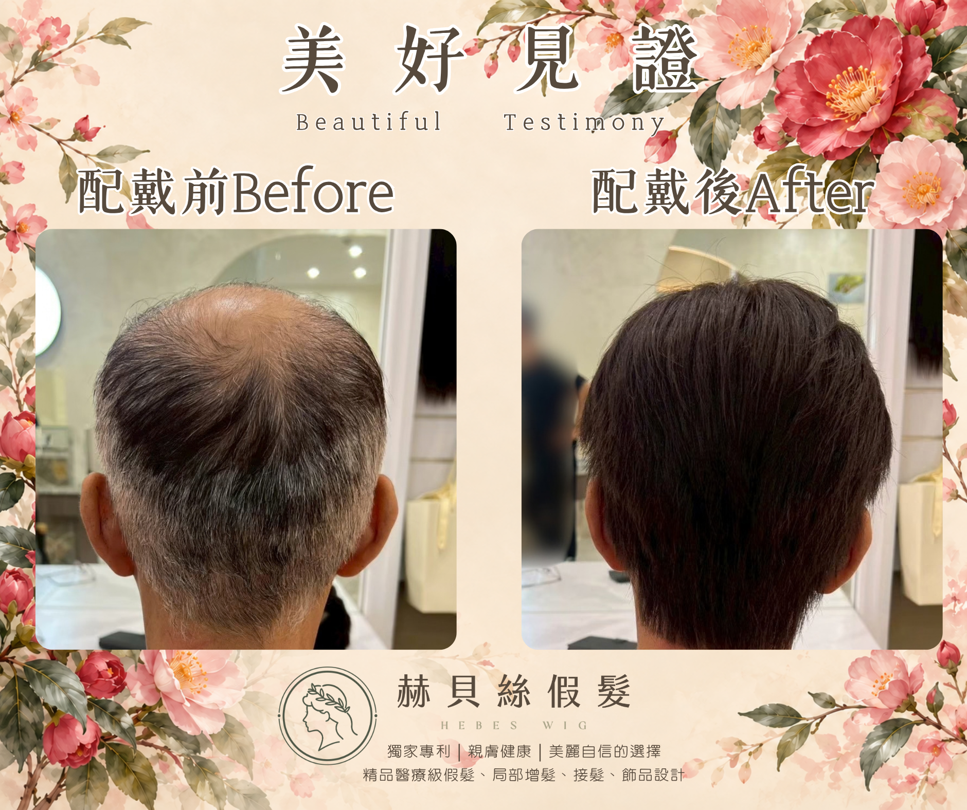 高先生的美好見證:用過,更懂得比較——赫貝絲男性假髮,找回年輕二十歲的帥氣英姿|配戴前後對比照