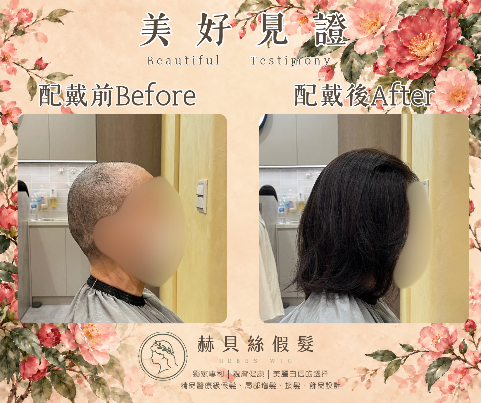 孫女士的美好見證:癌友互助社群的一份推薦,共同的自信與喜悅|配戴前後對比照