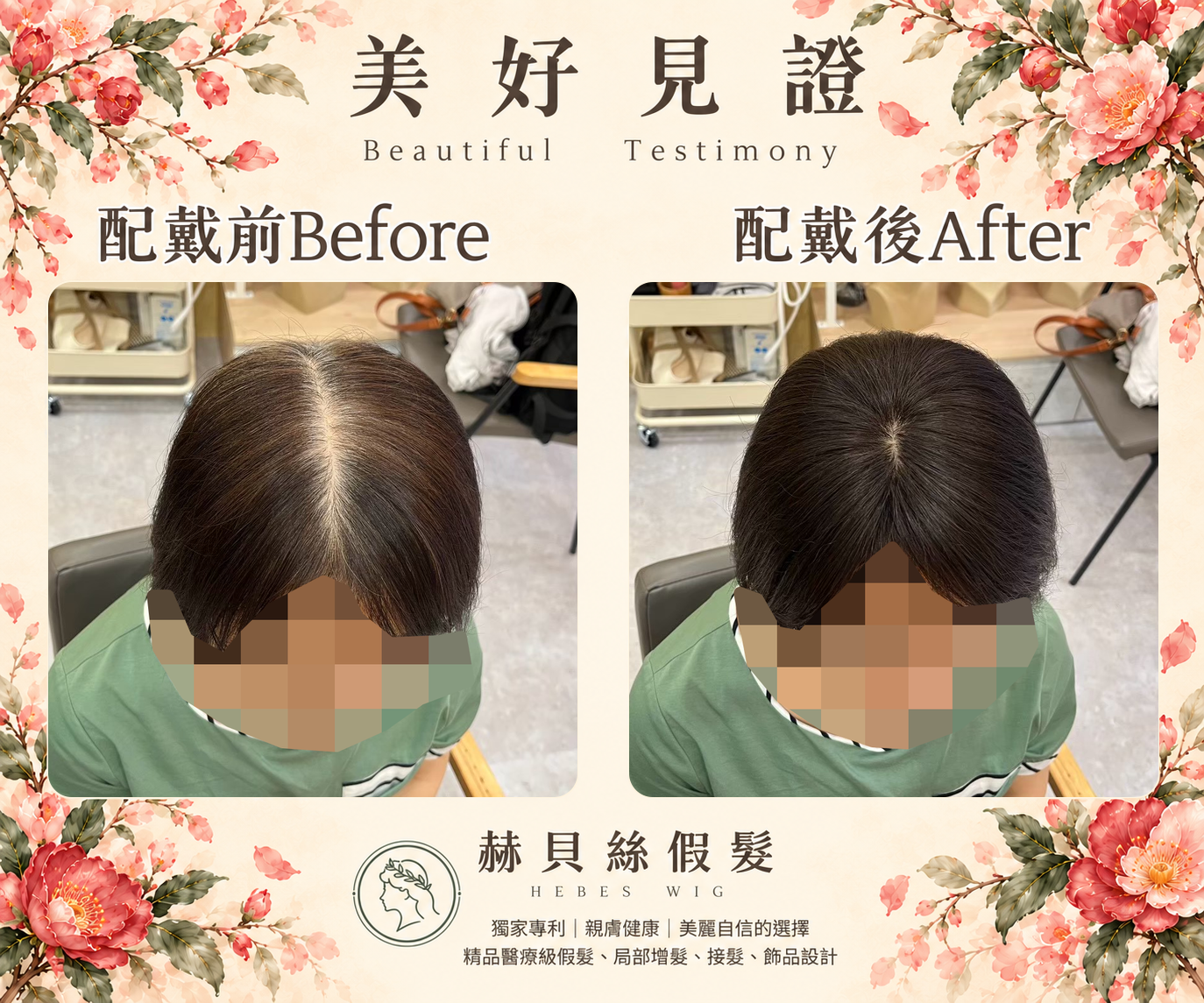 游女士的美好見證:同事的親身推薦,找到輕鬆回春的美麗方案|配戴前後對比照