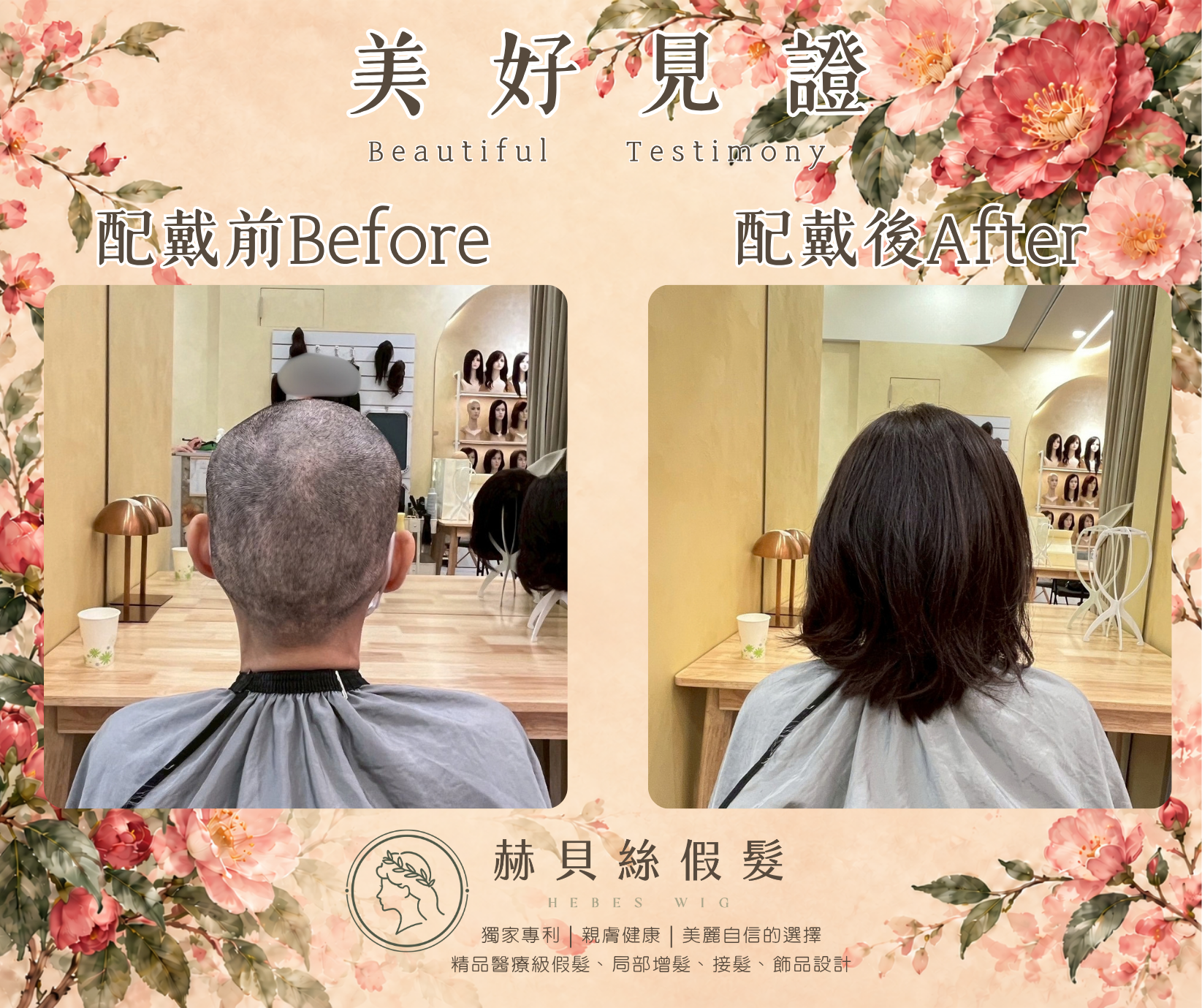 孫女士的美好見證:癌友互助社群的一份推薦,共同的自信與喜悅|配戴前後對比照