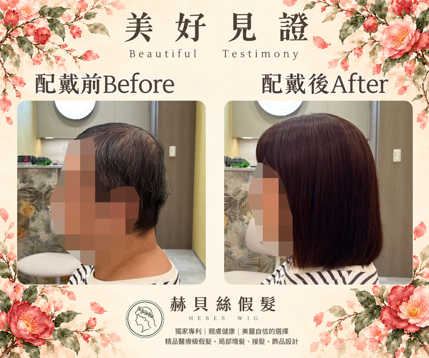 張女士的美好見證:擺脫髮量稀疏的困擾,在赫貝絲輕鬆找回美麗自信|配戴前後對比照