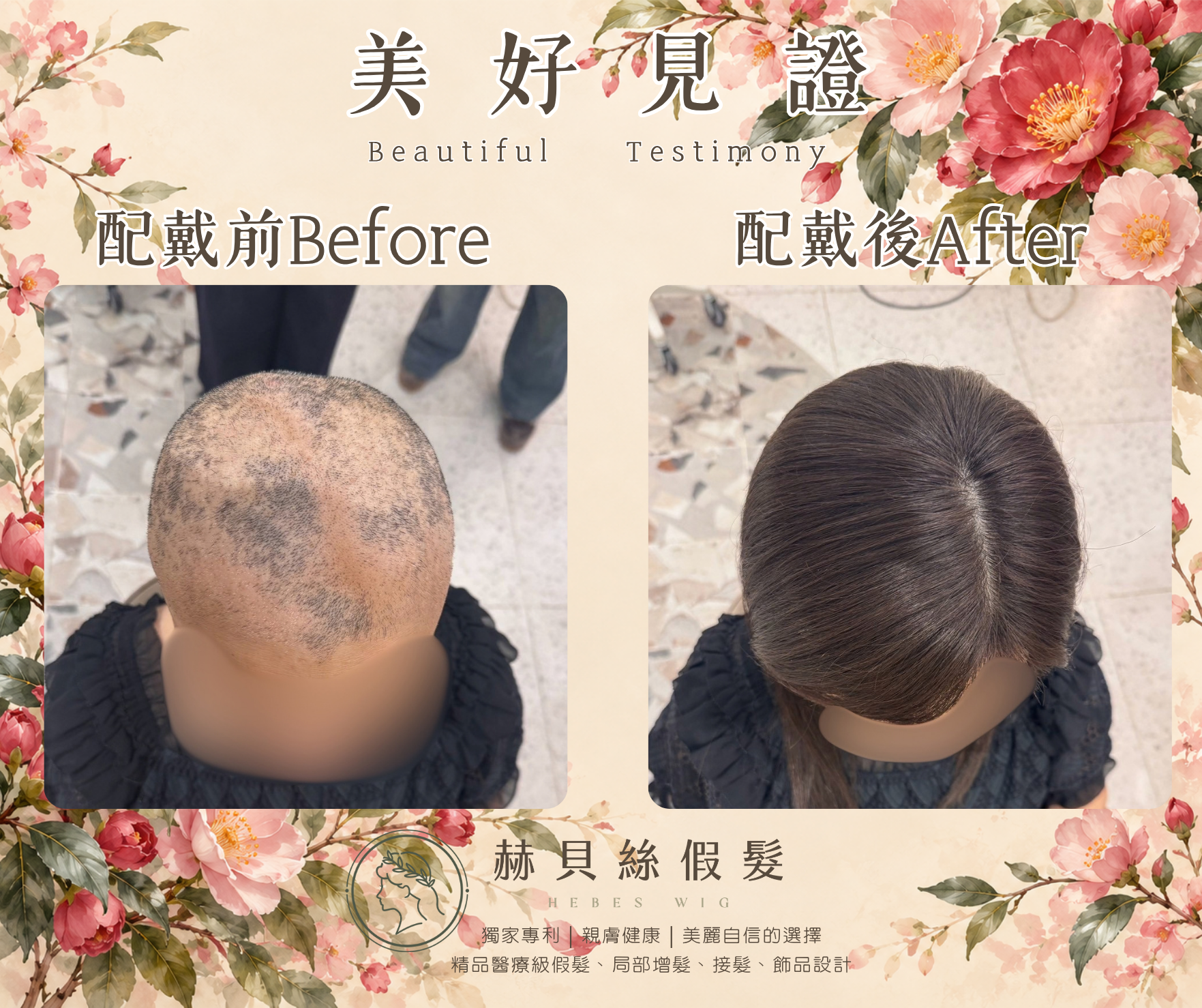 姚女士的美好見證:一份癌友間的推薦,一家人共同的喜悅。醫療假髮,溫柔陪伴自信回來|配戴前後對比照