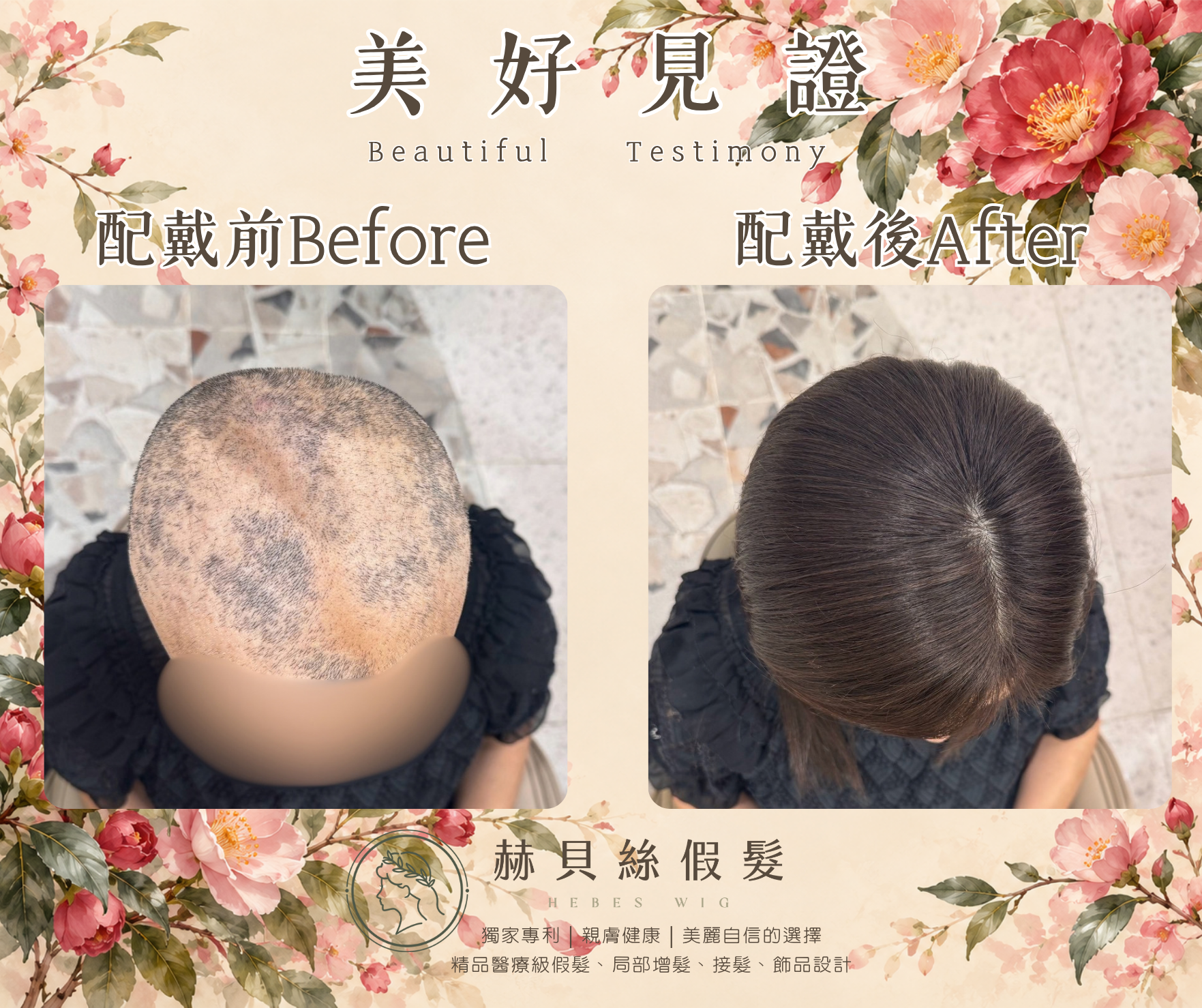 姚女士的美好見證:一份癌友間的推薦,一家人共同的喜悅。醫療假髮,溫柔陪伴自信回來|配戴前後對比照