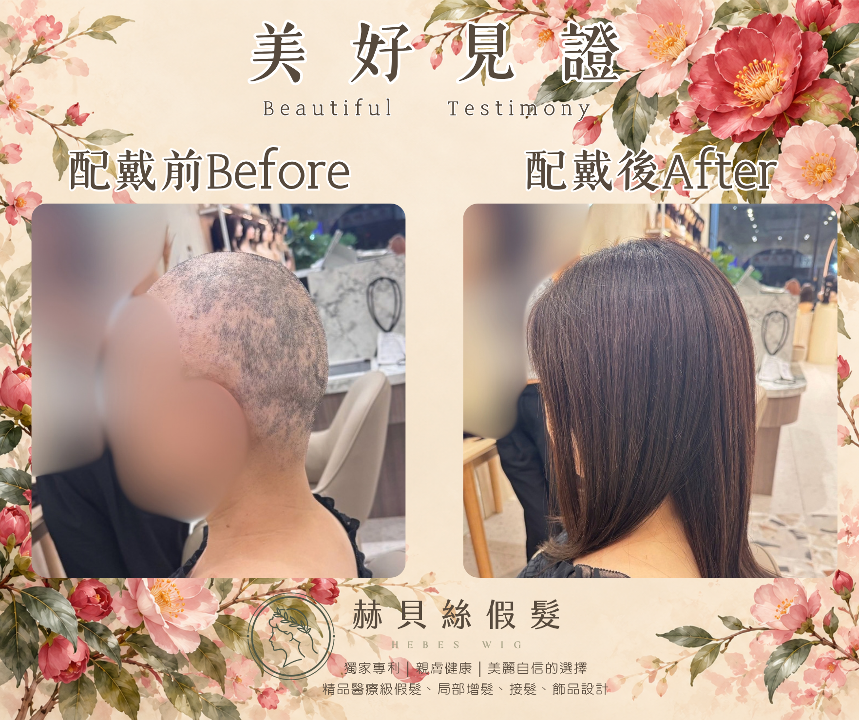 姚女士的美好見證:一份癌友間的推薦,一家人共同的喜悅。醫療假髮,溫柔陪伴自信回來|配戴前後對比照