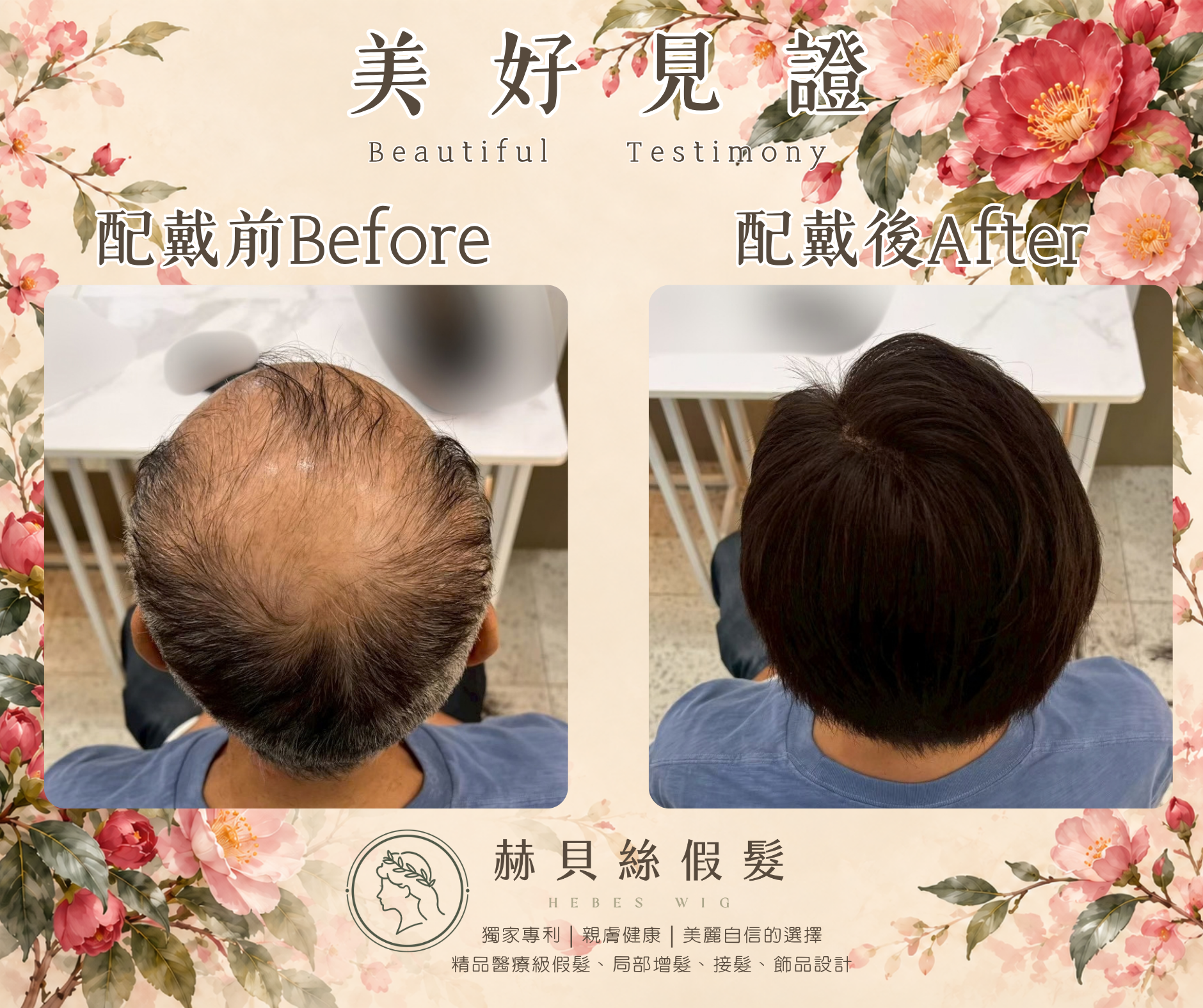高先生的美好見證:用過,更懂得比較——赫貝絲男性假髮,找回年輕二十歲的帥氣英姿|配戴前後對比照