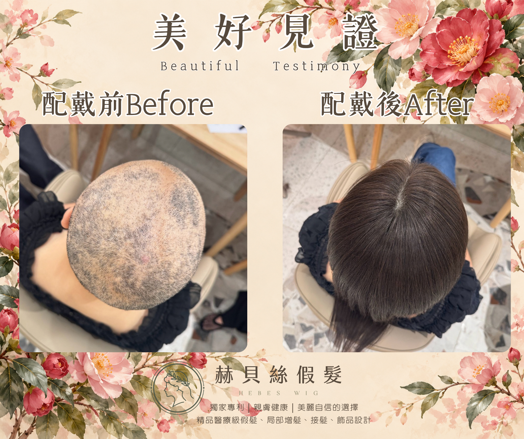 姚女士的美好見證:一份癌友間的推薦,一家人共同的喜悅。醫療假髮,溫柔陪伴自信回來|配戴前後對比照