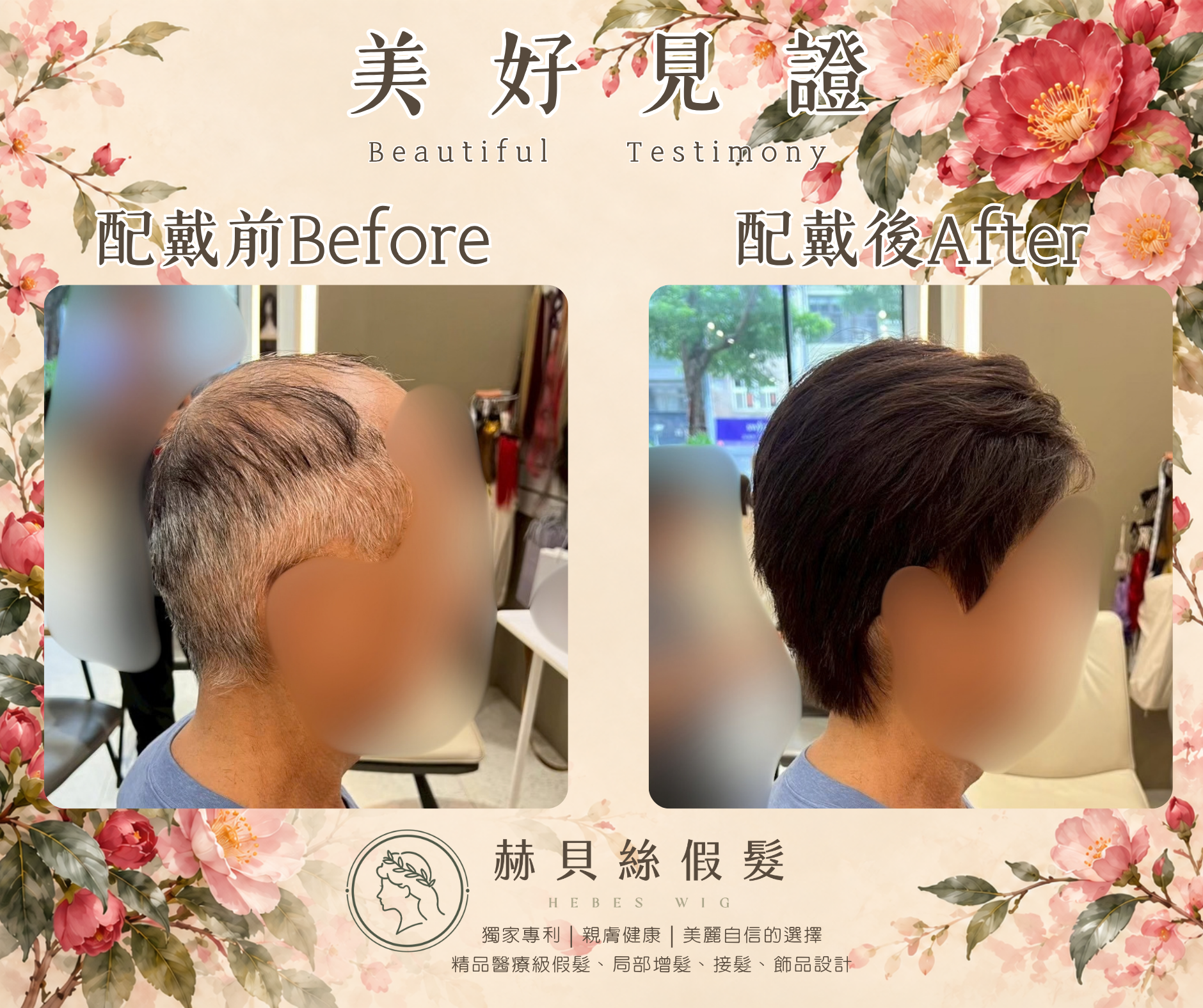 高先生的美好見證:用過,更懂得比較——赫貝絲男性假髮,找回年輕二十歲的帥氣英姿|配戴前後對比照