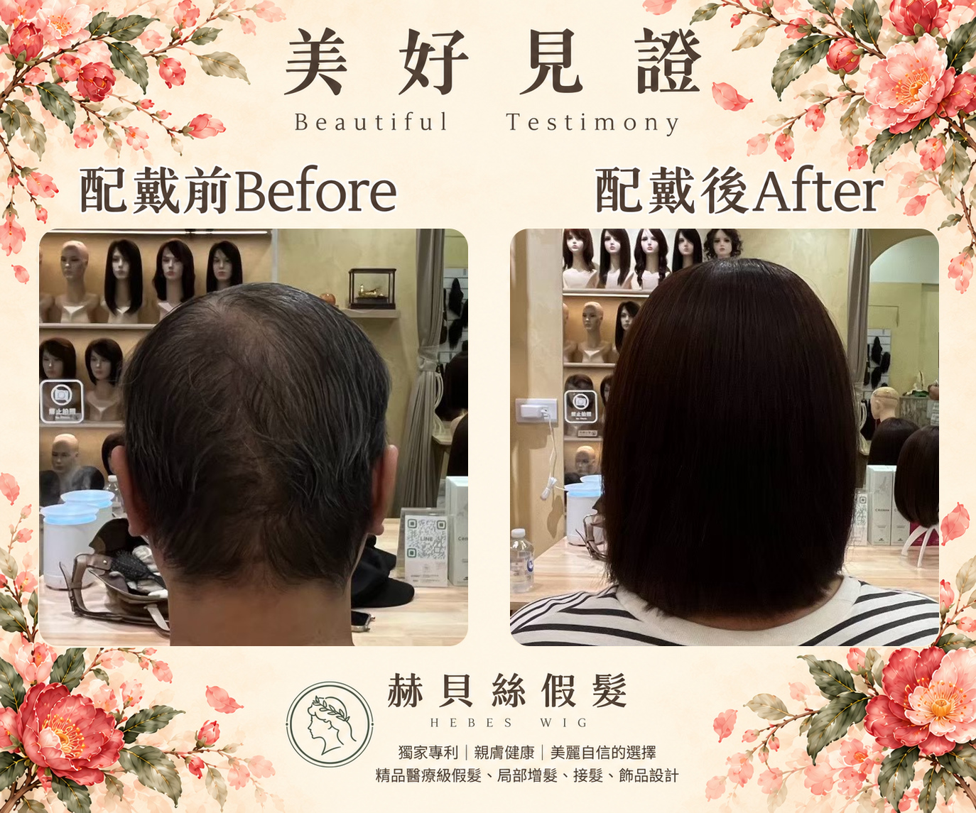 張女士的美好見證:擺脫髮量稀疏的困擾,在赫貝絲輕鬆找回美麗自信|配戴前後對比照