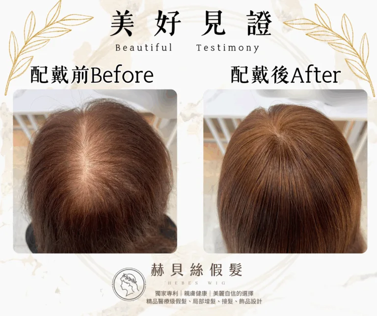 李女士官方見證圖片